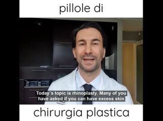 Rinoplastica - Dr. Paolo Montemurro