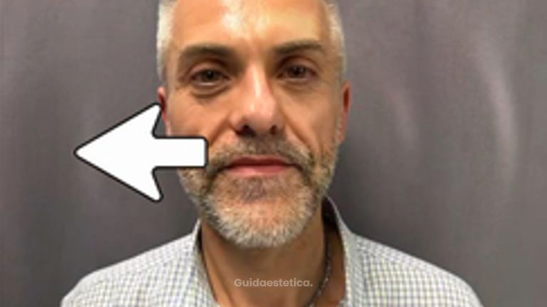 Prof. Dott. Massimiliano Giuliano Trattamento di medicina rigenerativa