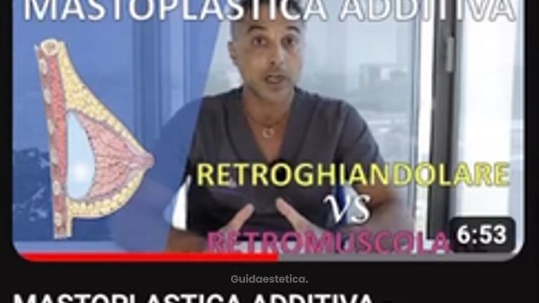 Mastoplastica additiva - Dr Antonio Tambuscio