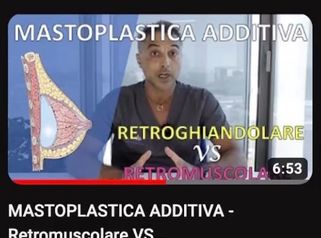 Mastoplastica additiva - Dr Antonio Tambuscio