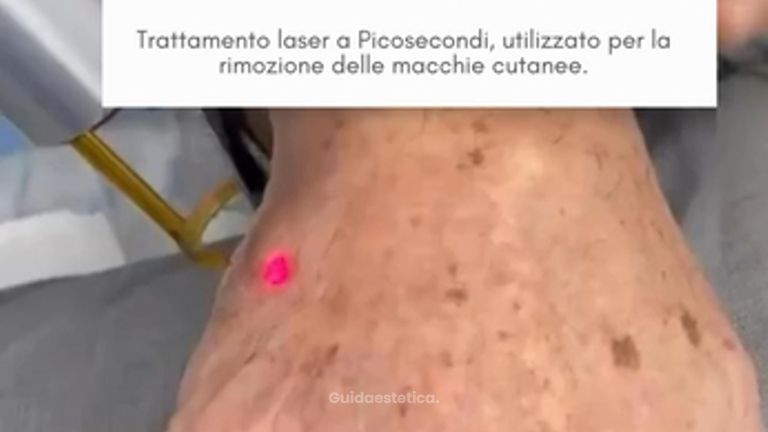 Macchie della pelle