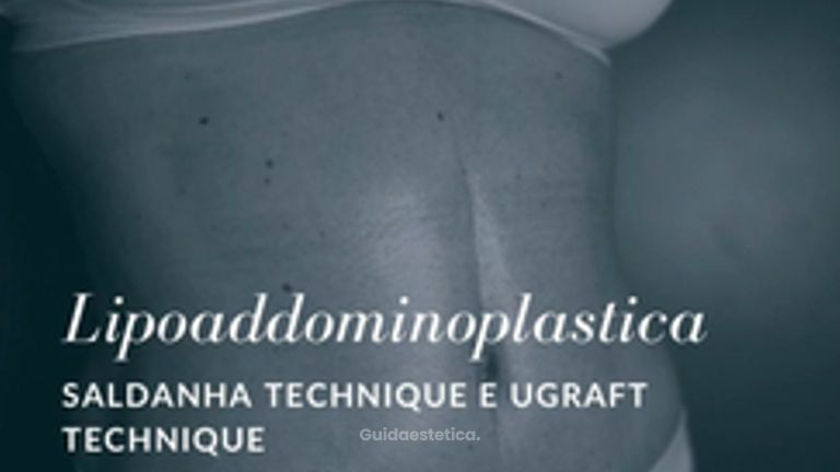 Lipoaddomniplastica - Dott. Arturo Amoroso