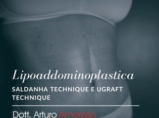 Lipoaddomniplastica - Dott. Arturo Amoroso