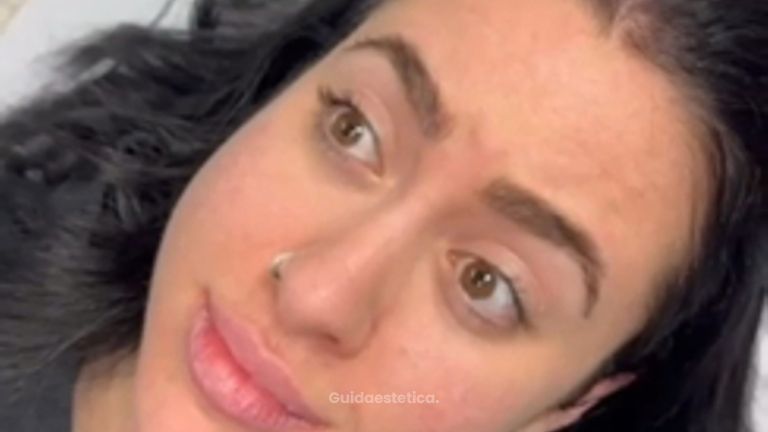 Prof. Dott. Massimiliano Giuliano tossina botulinica.