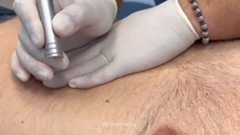 LASERTERAPIA - Dott. Umberto Fama
