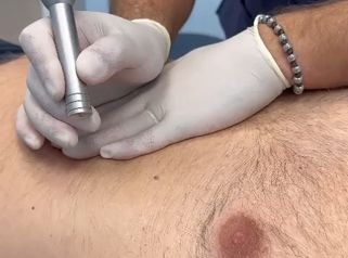 LASERTERAPIA - Dott. Umberto Fama