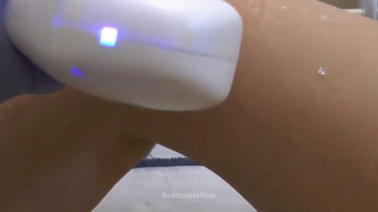 Laser Guida