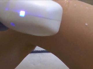 Laser Guida