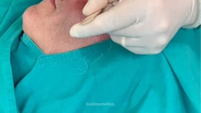 Lasertearpia - Dott. Umberto Fama