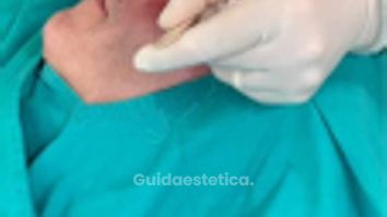 Lasertearpia - Dott. Umberto Fama