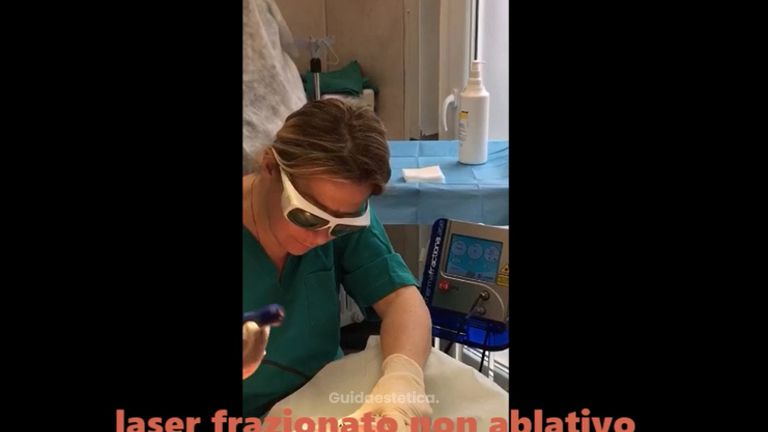 Laser frazionato no ablativo