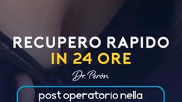 Dr Luciano Perrone il post operatorio con la Mastoplastica Argentina