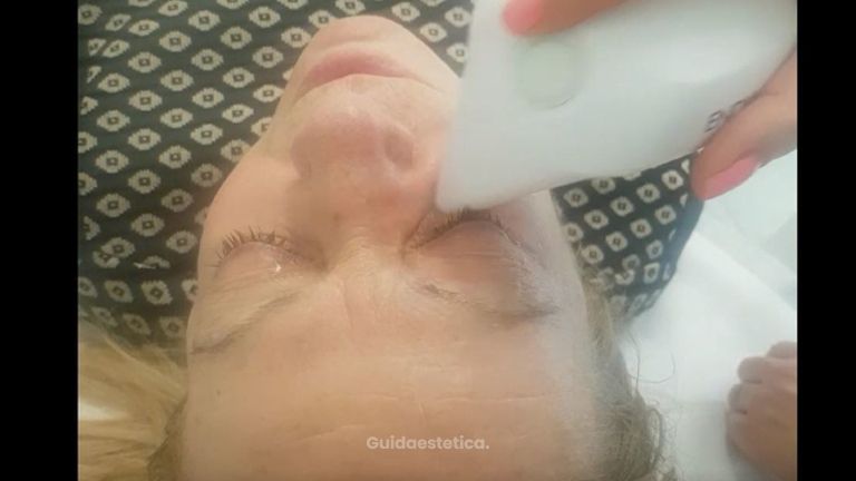 trattamento viso