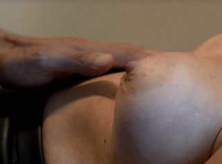 Le protesi nella mastoplastica additiva
