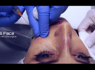 Full face - Jumeaux