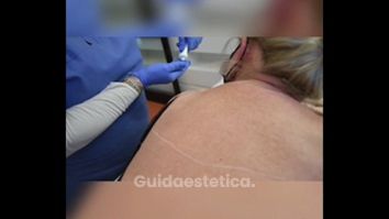 Microneeding medico - Dottoressa Serafina Ghianda