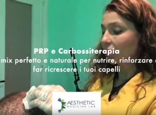 Post Video PRP e Carbossiterapia 