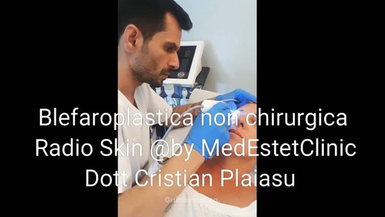 Medestetclinic: Blefaroplastica non chirurgica