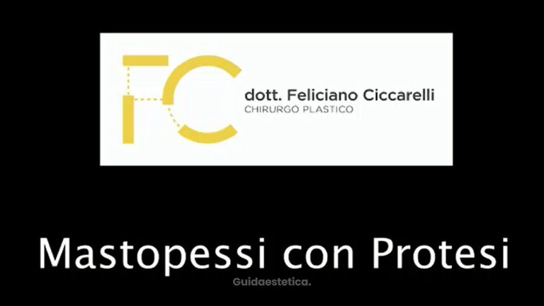 Mastopessi con protesi - Dott. Feliciano Ciccarelli