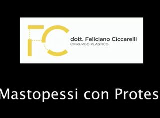 Mastopessi con protesi - Dott. Feliciano Ciccarelli