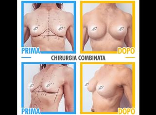 Combined surgery