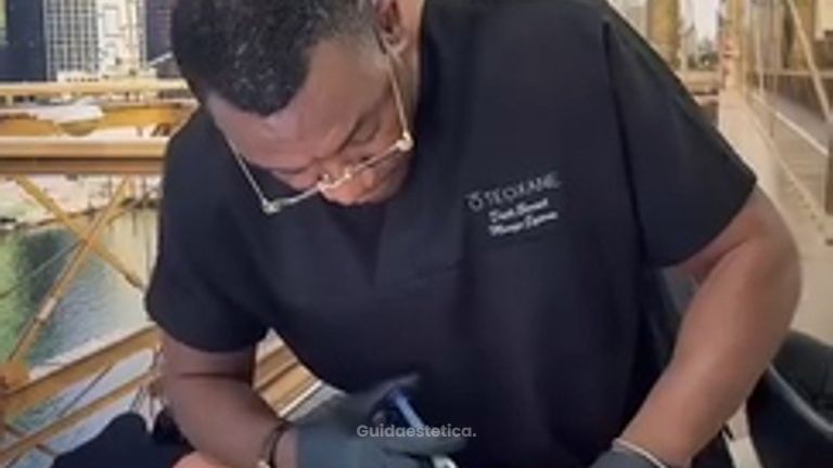 Dott. Benoit Menye Filler glutei: riempimento dei glutei con acido ialuronico