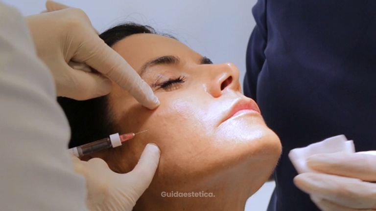Ristrutturare il viso con l’acido ialuronico