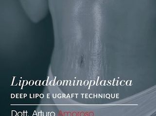 Lipoaddominoplastica - Dott. Arturo Amoroso