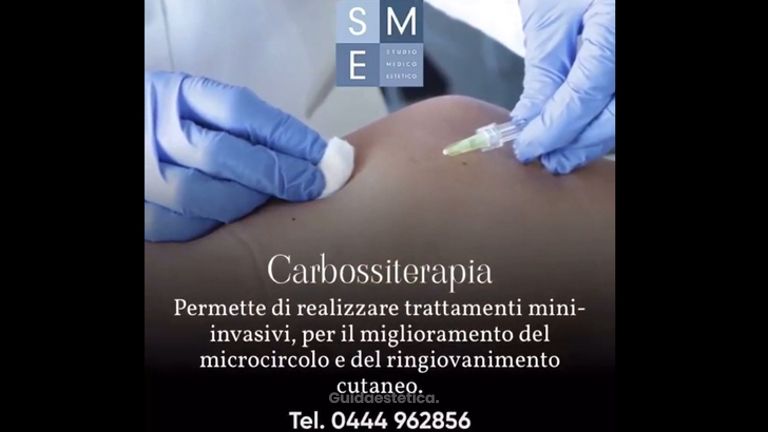 Carbossiterapia - Dott. Ruggero Sinigaglia