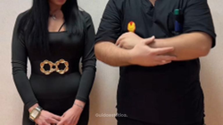 Dott. Antonio Vernillo Nancy: Ricostruzione addominale: risultato a 8 mesi dopo cicatrice deturpante