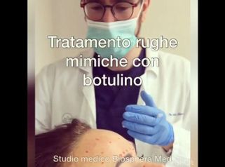 Botulino - Studio medico BiospheraMed