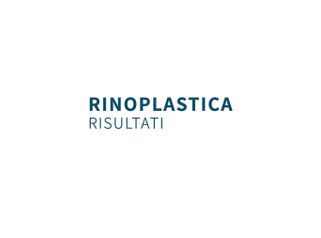 Rinoplastica, risultati - Dottor Gianluca Campiglio