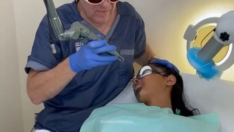 Laser carbon peel