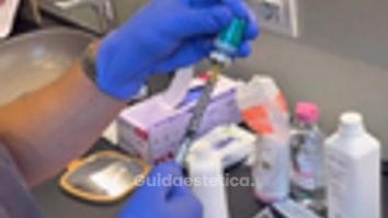 Faceland Biorivitalizzazione per occhiaie